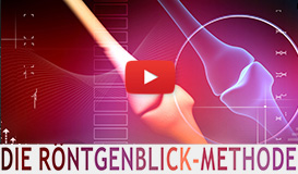 roentgenblick video prev3